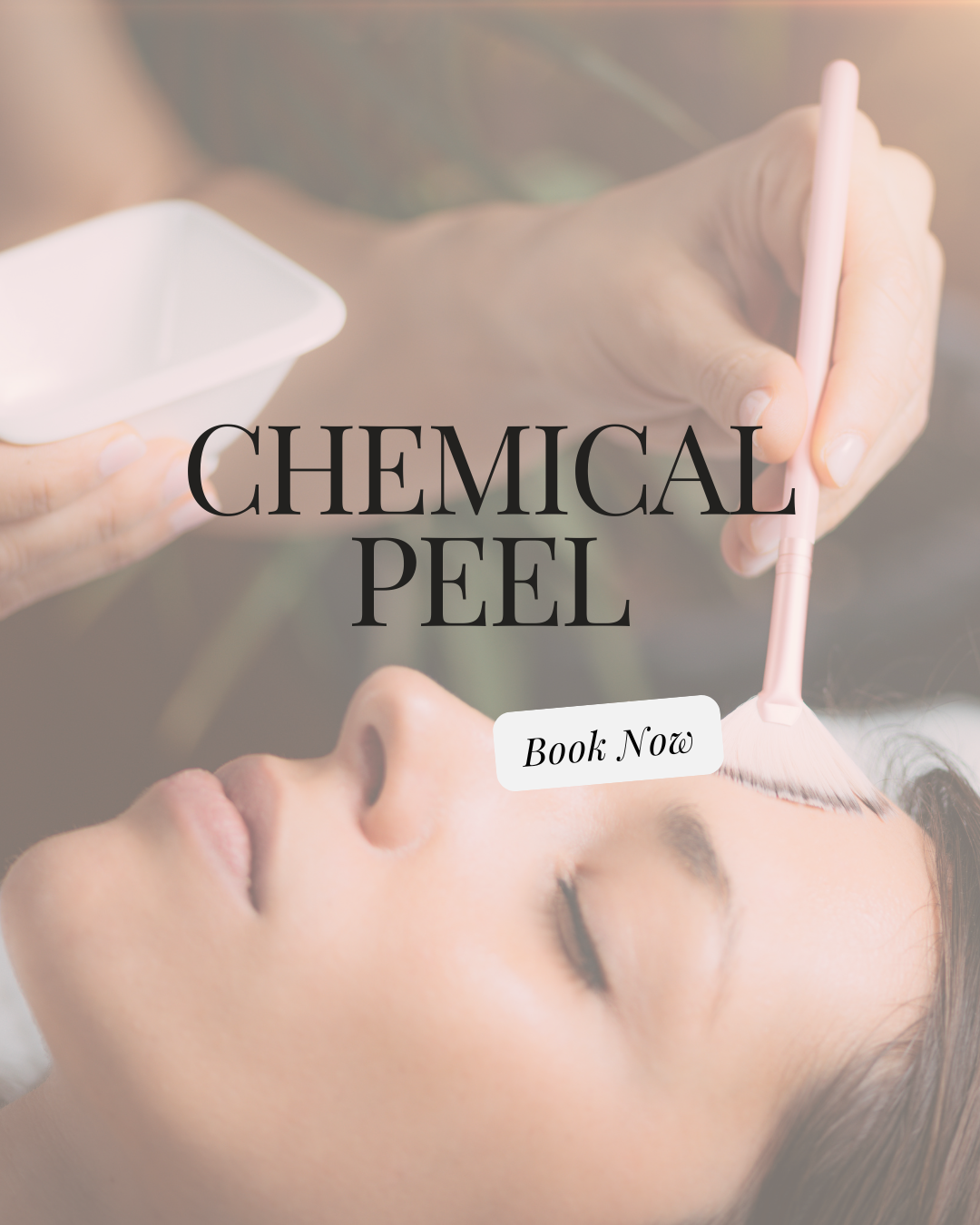CHEMICAL PEEL